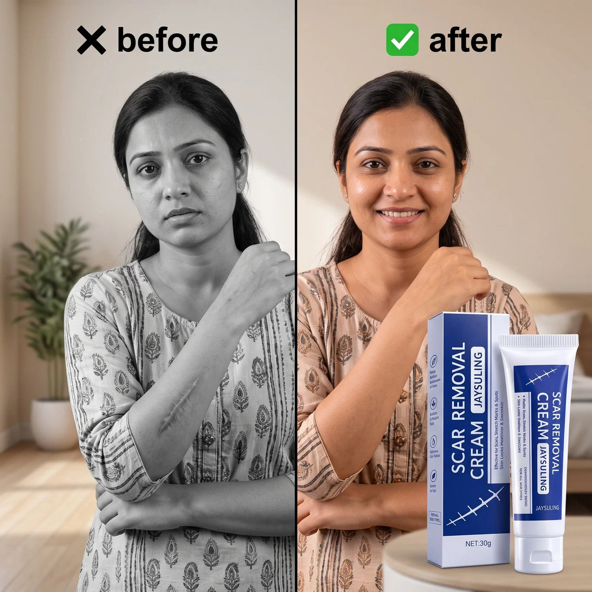 DermaSil™ – Silicone Scar & Stretch Mark Gel | Softens, Flattens & Fades | Face & Body